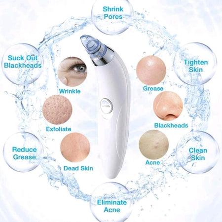 Derma Pore Cleaning Device with Vacuum Action - Cordless Blackhead Remover